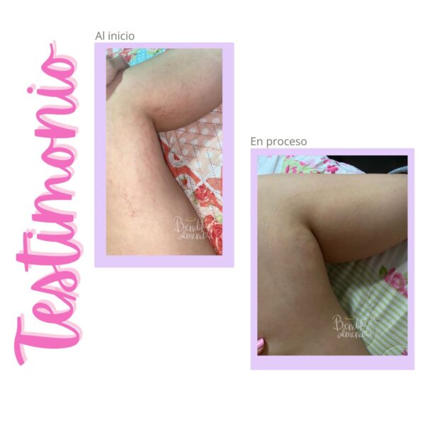 Kit PostParto con gel - Imagen 5