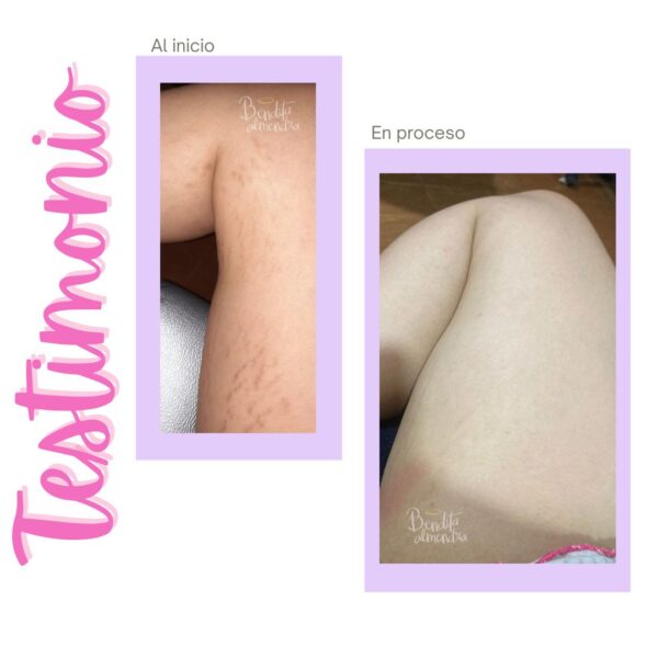 Kit PostParto con gel - Imagen 6